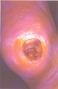 fig03-05.gif