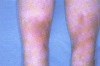 fig04-04.gif
