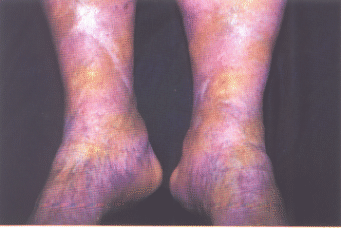 fig04-05.gif