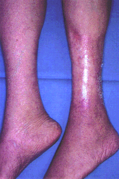 fig08-04a.gif
