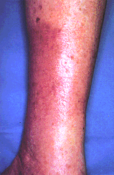 fig08-05a.gif