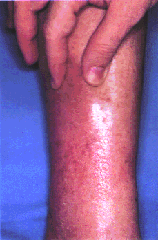 fig08-05b.gif