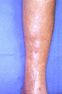 fig08-07.gif