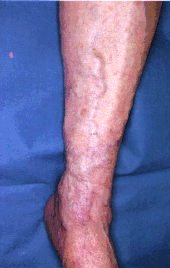 fig08-13.gif