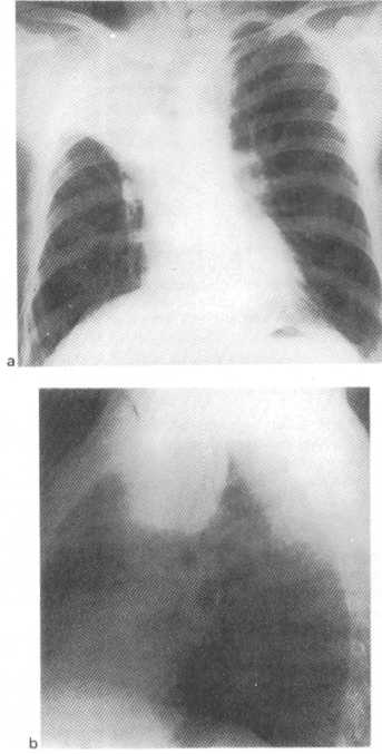 fig04-6.gif