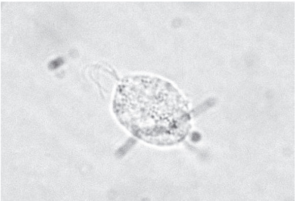 Trichomonas Vaginalis Wet Mount