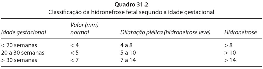 Classificação da hidronefrose fetal