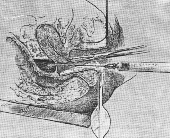 fig18-01.gif