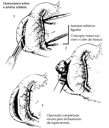 fig18-02.gif