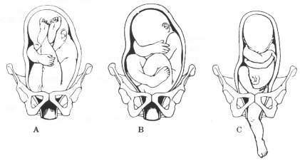 fig30-06.gif