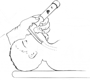 fig33-03.gif