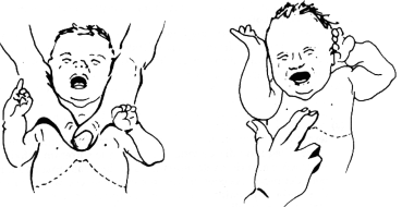 fig33-05.gif