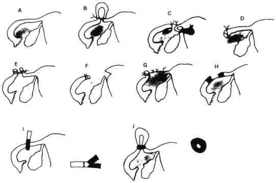 fig31-01.gif