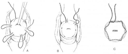 fig40-01.gif