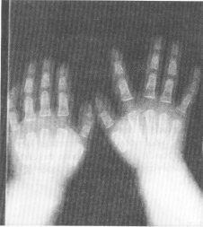 fig49-03.gif
