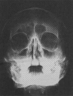 fig01-10.gif
