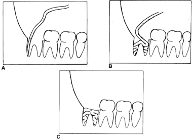 fig10-07.gif