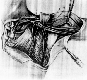 fig02-3.gif