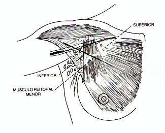 fig10-3.gif
