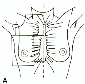 fig13-3a.gif