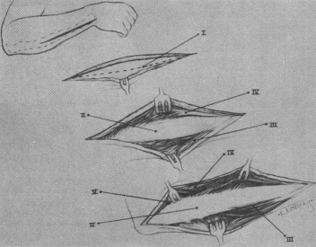 fig01-10.gif