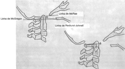 fig07-01.gif