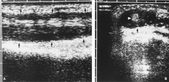 fig04-10.gif