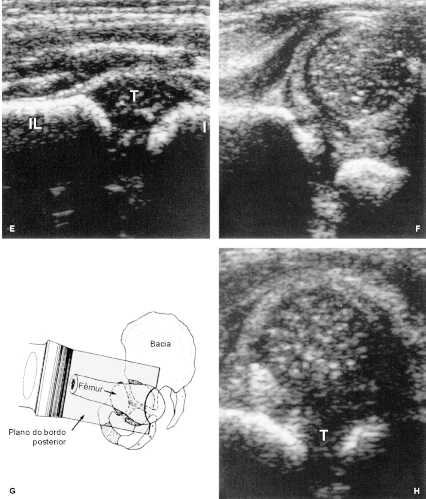 fig12-02a.gif