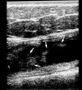 fig13-02.gif