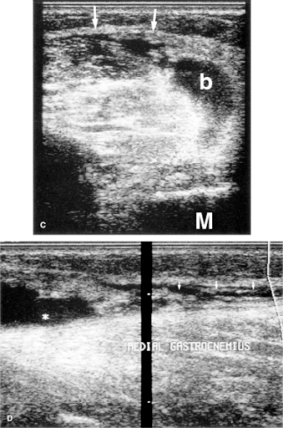fig13-10a.gif