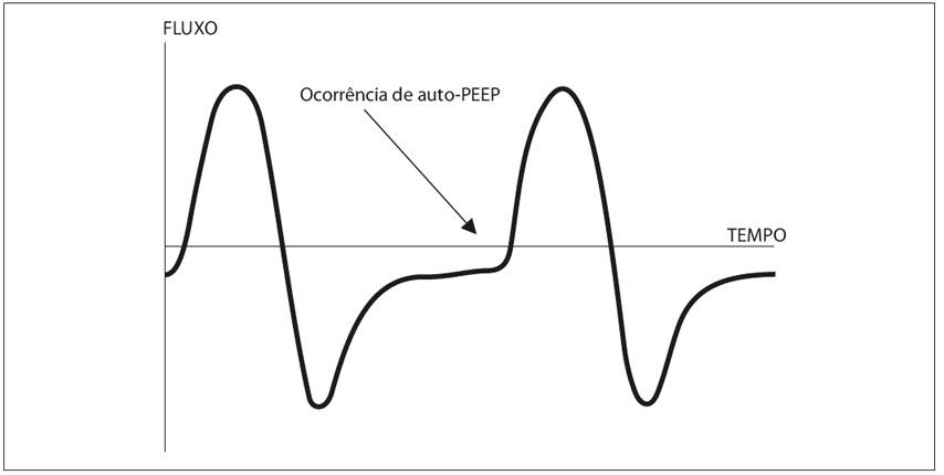 Visualização da auto-PEEP