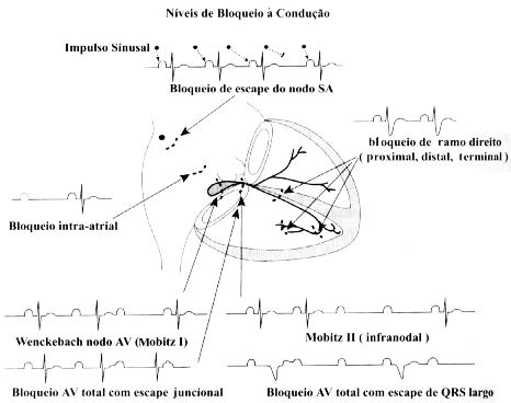 Figura 32-01