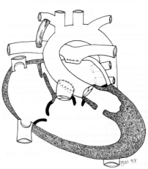 Figura A13
