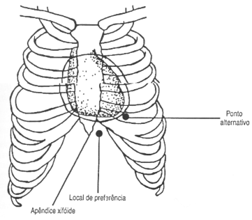 fig06-01.gif