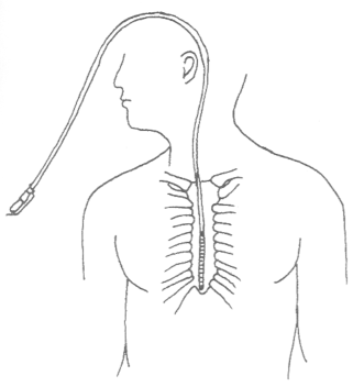 fig15-01.gif