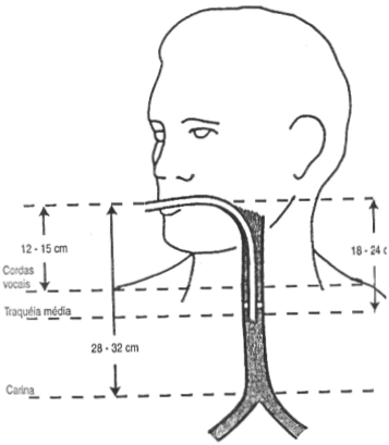 fig18-17.gif