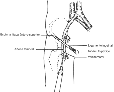fig03-11.gif (16224 bytes)