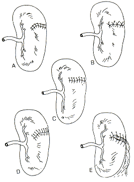 fig15-04.gif (11148 bytes)