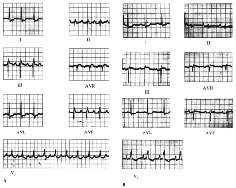 fig05-05.gif
