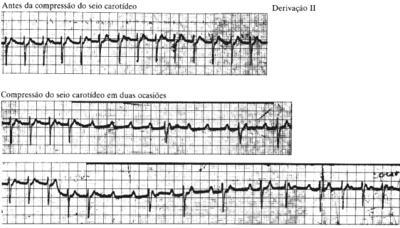 fig05-06.gif