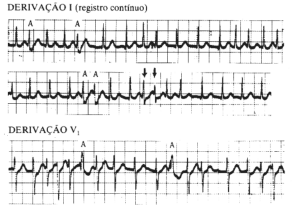 fig05-15.gif