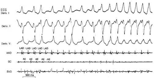 fig06-05.gif