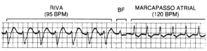 Fig. 07-06