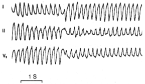 fig07-11.gif