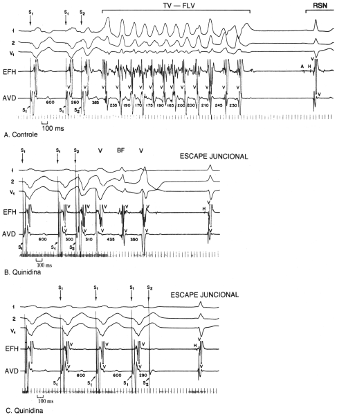 fig07-14.gif