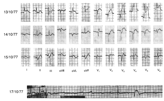 fig08-05.gif