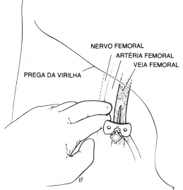 fig09-25.gif