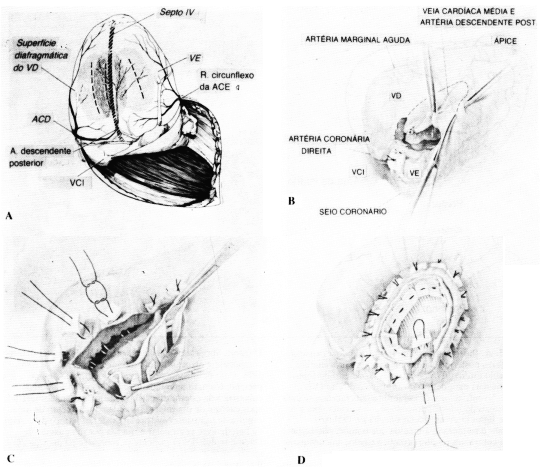 fig13-14.gif