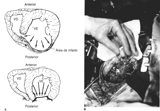 fig13-15.gif