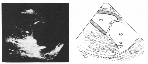 fig18-04.gif